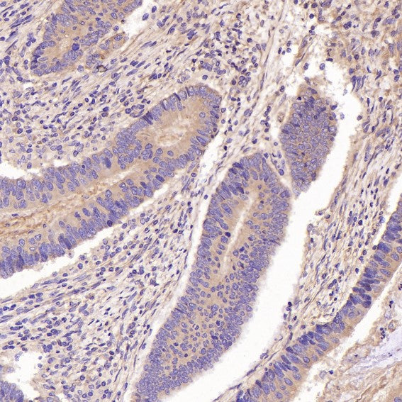 Anti-GSK3 beta Rabbit Monoclonal Antibody Boster Bio