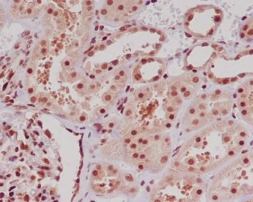 Anti-ERG Rabbit Monoclonal Antibody Boster Bio