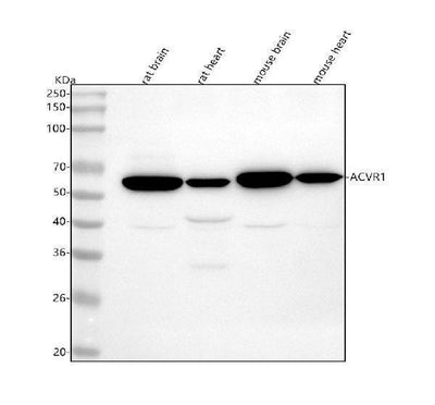 Anti-ACVR1 Rabbit Monoclonal Antibody Boster Bio