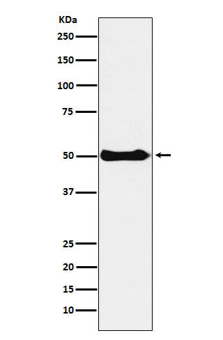 Anti-CSK Rabbit Monoclonal Antibody Boster Bio