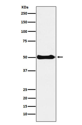 Anti-CSK Rabbit Monoclonal Antibody Boster Bio