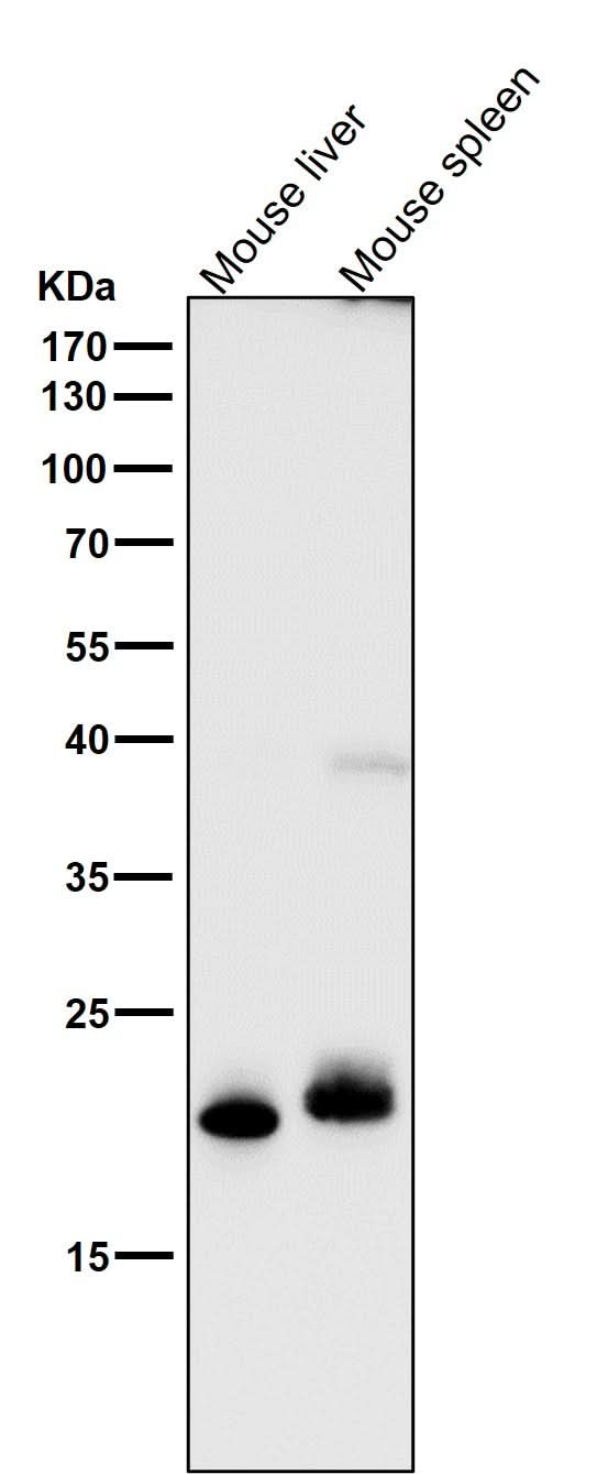 Anti-FGF21 Rabbit Monoclonal Antibody Boster Bio