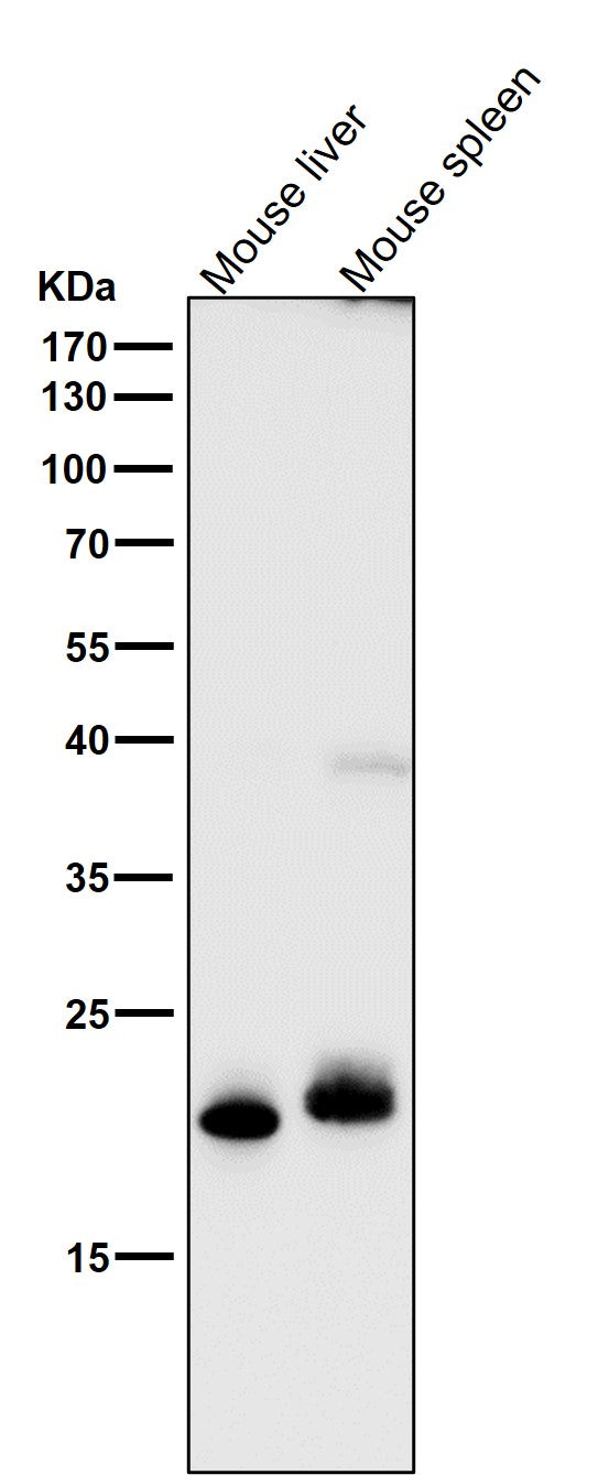 Anti-FGF21 Rabbit Monoclonal Antibody Boster Bio