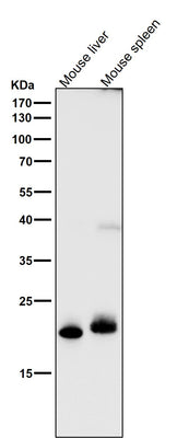 Anti-FGF21 Rabbit Monoclonal Antibody Boster Bio