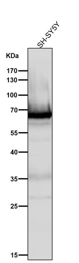 Anti-COX1 PTGS1 Rabbit Monoclonal Antibody Boster Bio