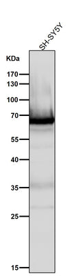 Anti-COX1 PTGS1 Rabbit Monoclonal Antibody Boster Bio