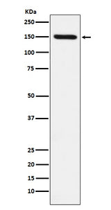 Anti-CD163 Rabbit Monoclonal Antibody Boster Bio