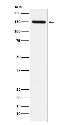 Anti-CD163 Rabbit Monoclonal Antibody Boster Bio