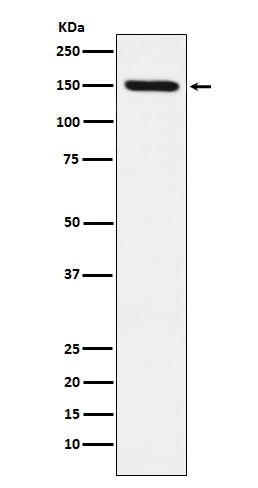 Anti-CD163 Rabbit Monoclonal Antibody Boster Bio