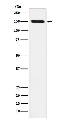 Anti-CD163 Rabbit Monoclonal Antibody Boster Bio