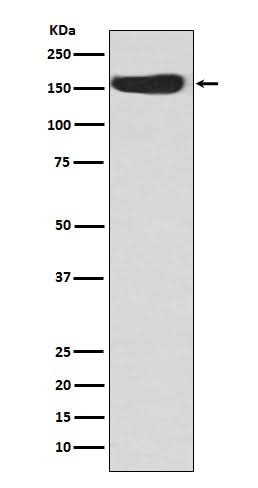 Anti-CD163 Rabbit Monoclonal Antibody Boster Bio