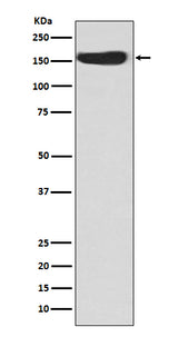 Anti-CD163 Rabbit Monoclonal Antibody Boster Bio