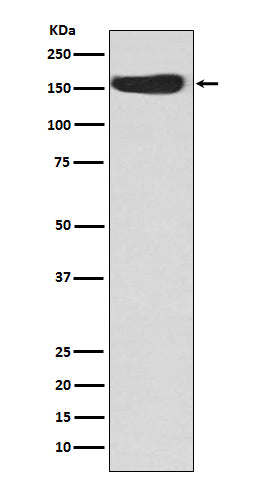 Anti-CD163 Rabbit Monoclonal Antibody Boster Bio