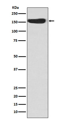 Anti-CD163 Rabbit Monoclonal Antibody Boster Bio