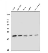 Anti-DHFR Antibody Picoband® (monoclonal, 3C8 Boster Bio