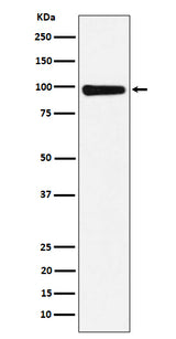 Anti-CHM Rabbit Monoclonal Antibody Boster Bio