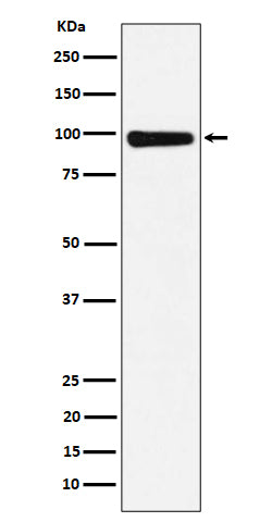 Anti-CHM Rabbit Monoclonal Antibody Boster Bio