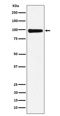 Anti-CHM Rabbit Monoclonal Antibody Boster Bio