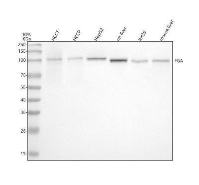 Anti-Fibrinogen alpha chain Rabbit Monoclonal Antibody Boster Bio