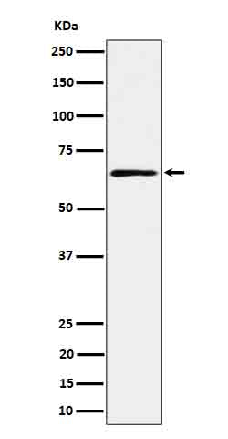Anti-RIP2 Rabbit Monoclonal Antibody Boster Bio