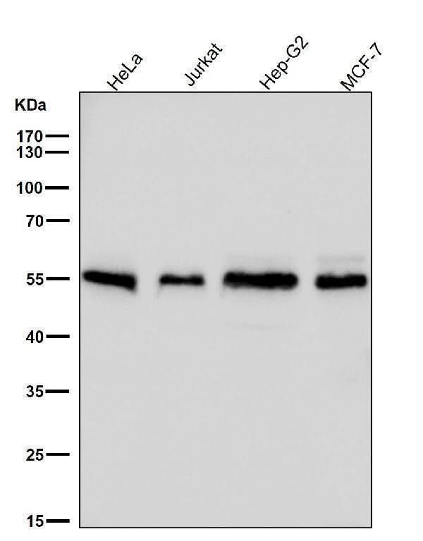 Anti-Apg12(Atg12) Rabbit Monoclonal Antibody Boster Bio