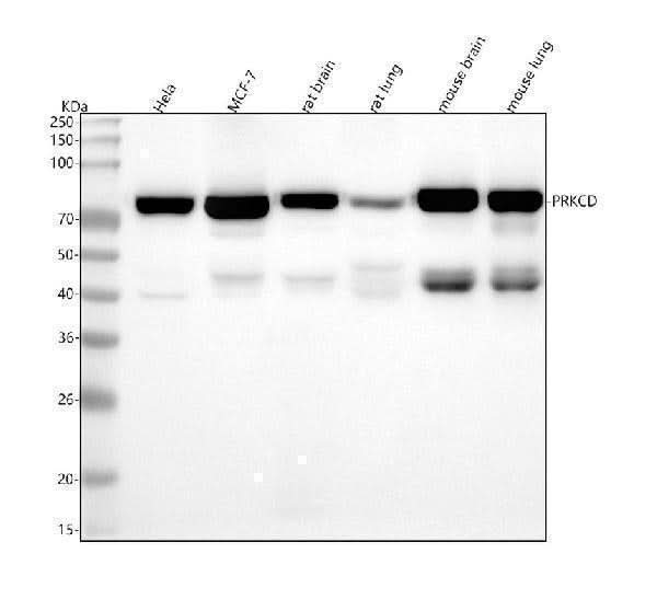 Anti-PKC delta PRKCD Rabbit Monoclonal Antibody Boster Bio
