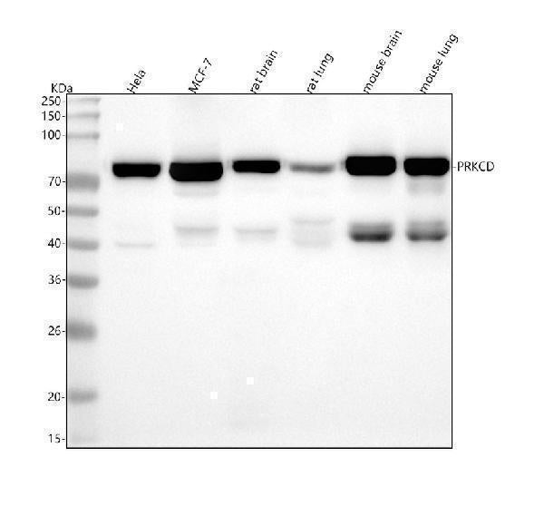 Anti-PKC delta PRKCD Rabbit Monoclonal Antibody Boster Bio