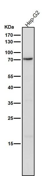 Anti-Phospho-PKC delta (Y311) Rabbit Monoclonal Antibody Boster Bio