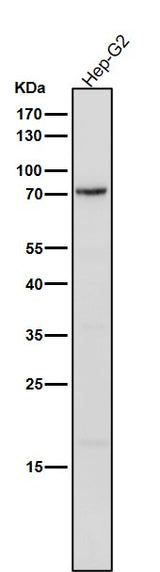 Anti-Phospho-PKC delta (Y311) Rabbit Monoclonal Antibody Boster Bio