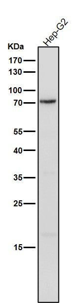 Anti-Phospho-PKC delta (Y311) Rabbit Monoclonal Antibody Boster Bio