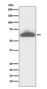 Anti-RPE65 Rabbit Monoclonal Antibody Boster Bio