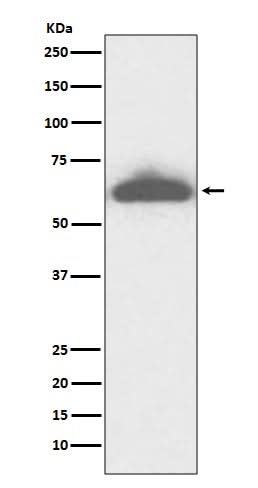 Anti-RPE65 Rabbit Monoclonal Antibody Boster Bio