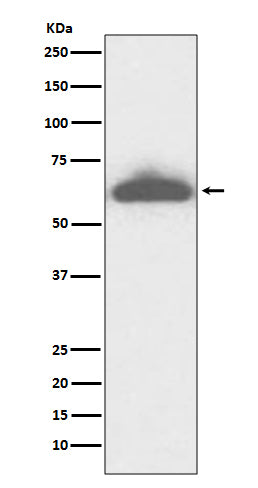 Anti-RPE65 Rabbit Monoclonal Antibody Boster Bio