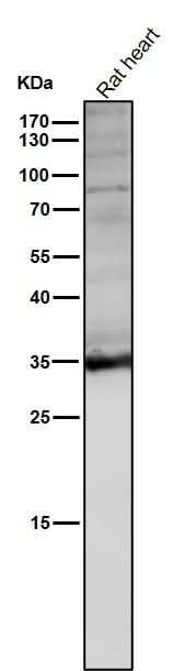 Anti-LDHA Rabbit Monoclonal Antibody Boster Bio