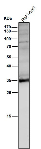 Anti-LDHA Rabbit Monoclonal Antibody Boster Bio