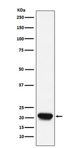Anti-RHEB Rabbit Monoclonal Antibody Boster Bio
