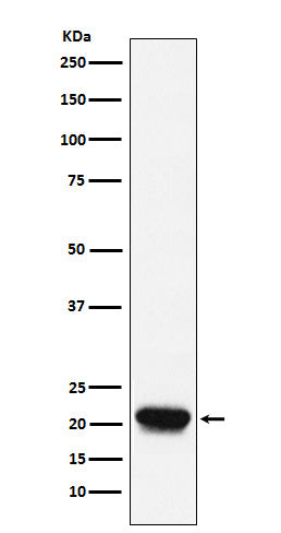 Anti-RHEB Rabbit Monoclonal Antibody Boster Bio