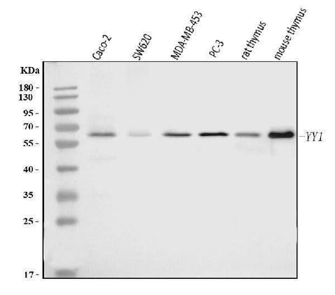 Anti-YY1 Antibody Picoband® (monoclonal, 2C10F9 Boster Bio