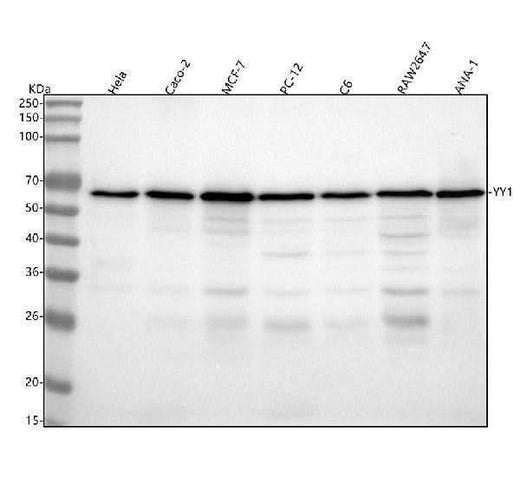Anti-YY1 Rabbit Monoclonal Antibody Boster Bio