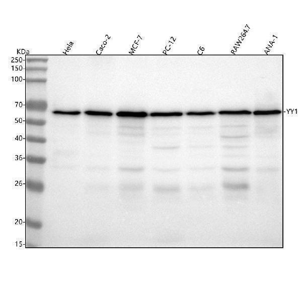 Anti-YY1 Rabbit Monoclonal Antibody Boster Bio