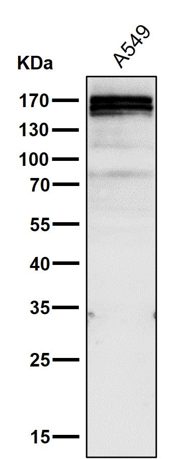 Anti-RelB Rabbit Monoclonal Antibody Boster Bio