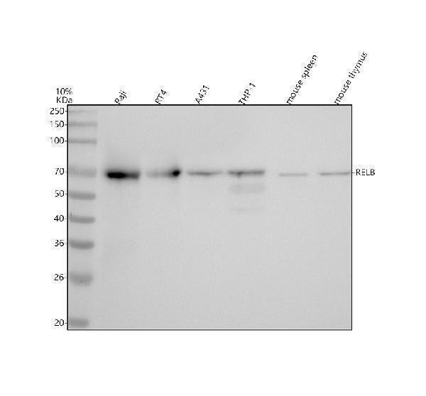 Anti-RelB Rabbit Monoclonal Antibody Boster Bio