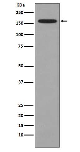 Anti-KMT4 / Dot1L Rabbit Monoclonal Antibody Boster Bio
