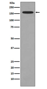 Anti-KMT4 / Dot1L Rabbit Monoclonal Antibody Boster Bio