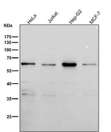 Anti-PAX7 Rabbit Monoclonal Antibody Boster Bio