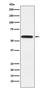 Anti-Lgi1 Rabbit Monoclonal Antibody Boster Bio
