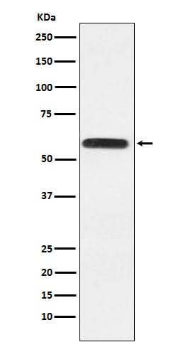 Anti-Lgi1 Rabbit Monoclonal Antibody Boster Bio