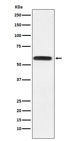Anti-Lgi1 Rabbit Monoclonal Antibody Boster Bio