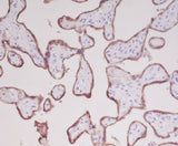 Anti-Growth Hormone GH1 Rabbit Monoclonal Antibody Boster Bio