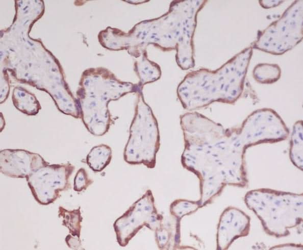 Anti-Growth Hormone GH1 Rabbit Monoclonal Antibody Boster Bio